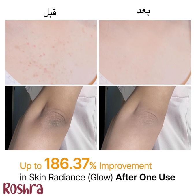 اسپری پیل شات کوجیک اسید دکتر ملاکسین image